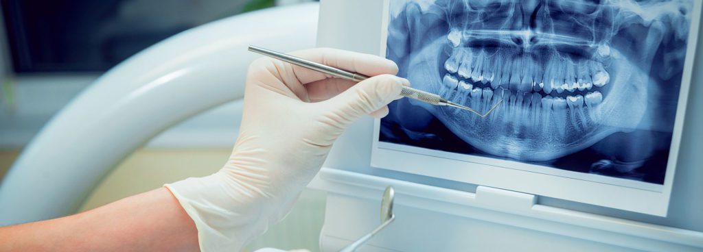 Dentist discussing the patients teeth by pointing with dental tool